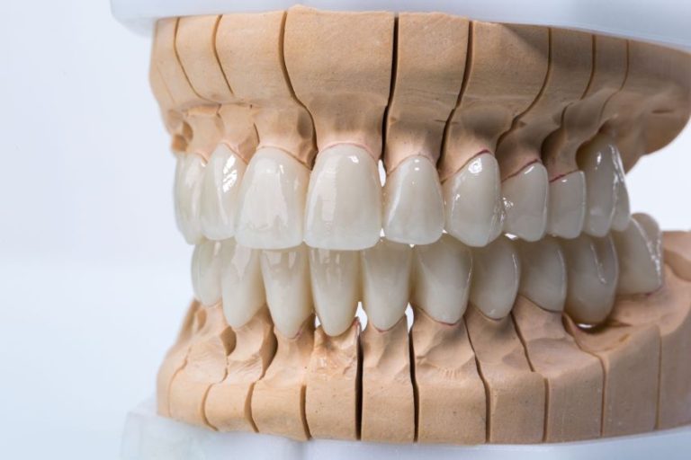 4 klaidingi teiginiai apie dantų protezavimą